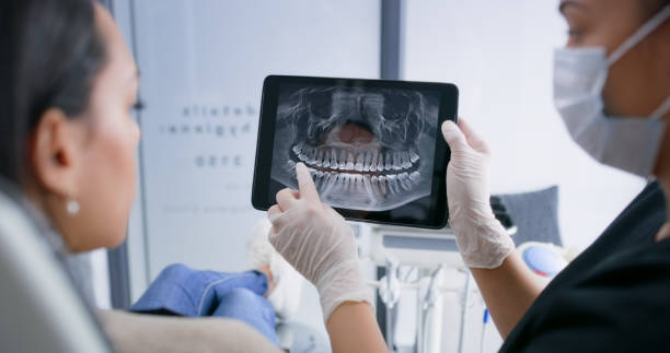Licensed Tooth Extraction service in Tarrytown, NY - Smile Center Dentistry